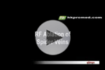 RF Ablation of Spider Veins